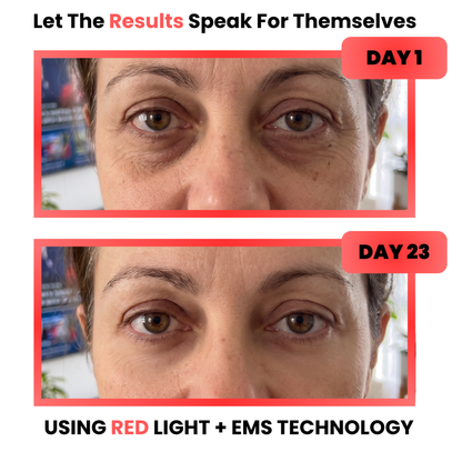 Lumera Pro - Red Light Therapy + EMS To Erase Eye Bags